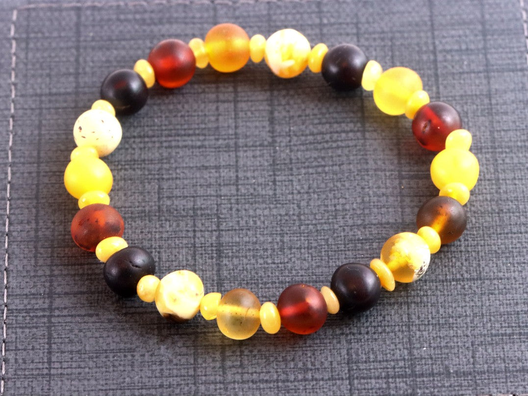 Semi-Polished Baltic Amber Bracelet with Spacer Beads – Limited Edition