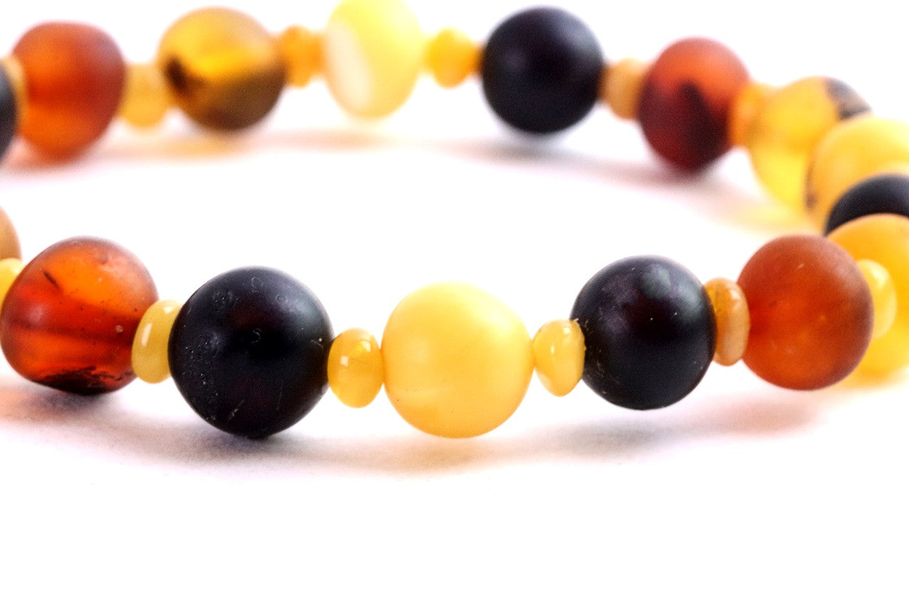 Semi-Polished Baltic Amber Bracelet with Spacer Beads – Limited Edition
