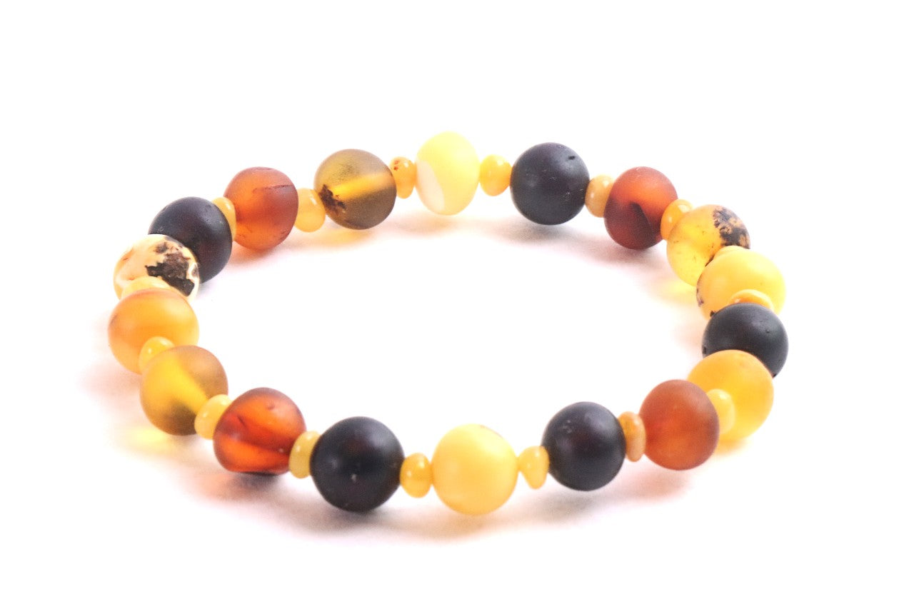 Semi-Polished Baltic Amber Bracelet with Spacer Beads – Limited Edition