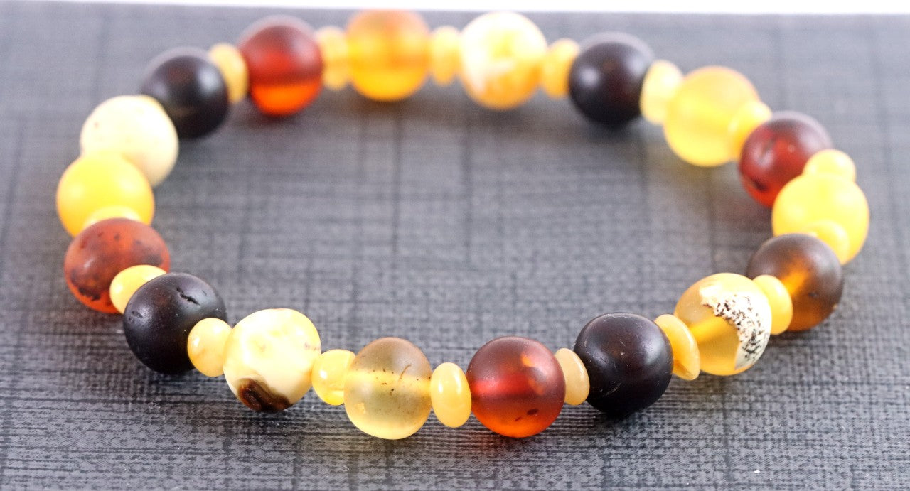 Semi-Polished Baltic Amber Bracelet with Spacer Beads – Limited Edition