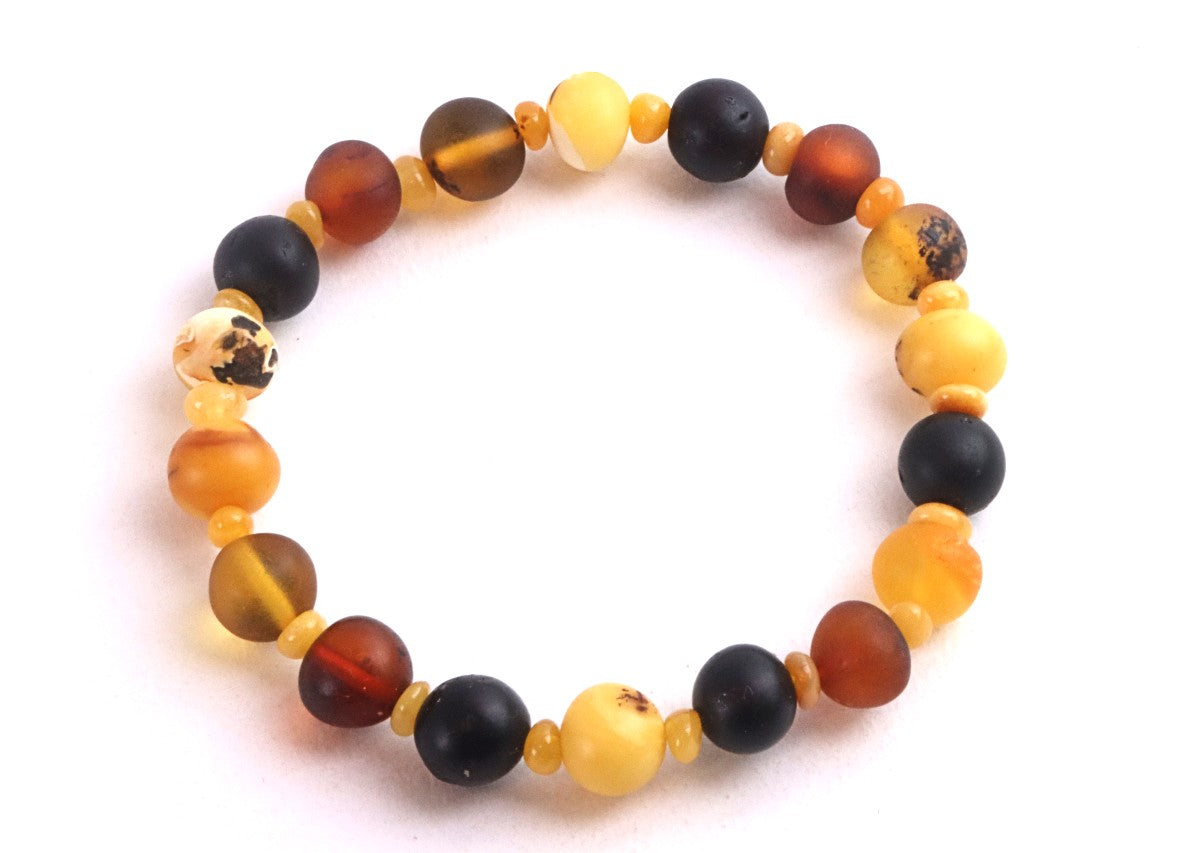 Semi-Polished Baltic Amber Bracelet with Spacer Beads – Limited Edition