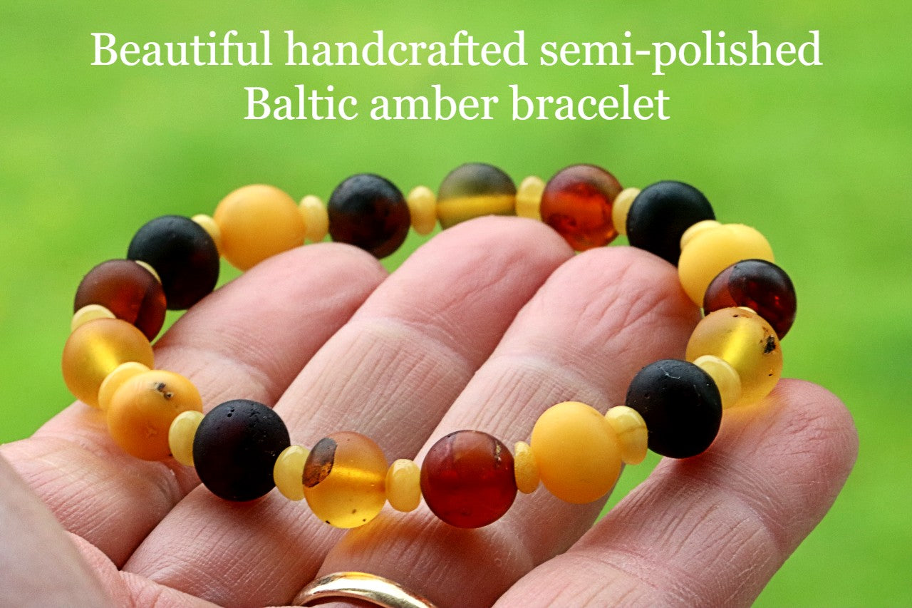 Semi-Polished Baltic Amber Bracelet with Spacer Beads – Limited Edition
