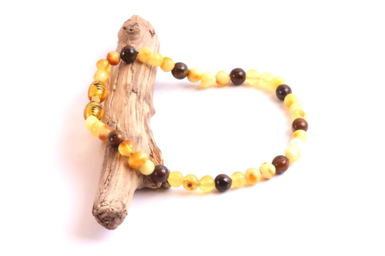 White and lemon Baltic Amber and Tigers Eye Adult Anklet