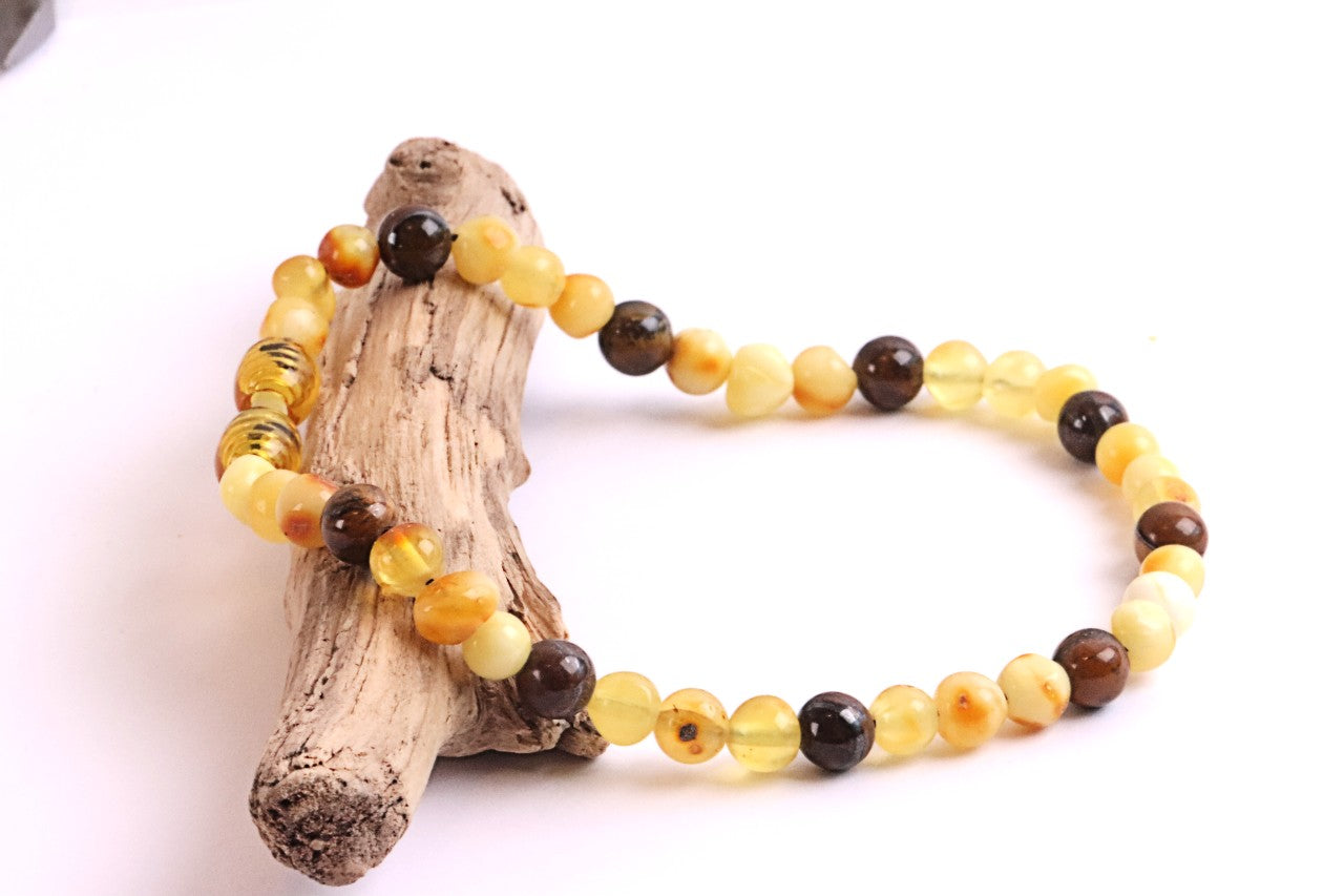 White and lemon Baltic Amber and Tigers Eye Adult Anklet
