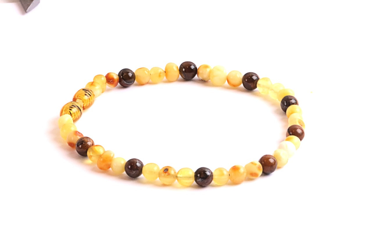 White and lemon Baltic Amber and Tigers Eye Adult Anklet