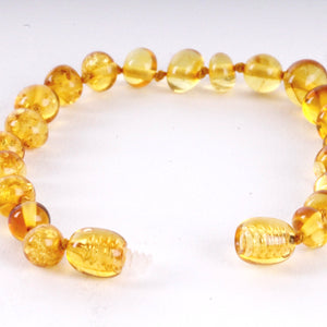 Amber Anklet Honey Beads Amber SOS