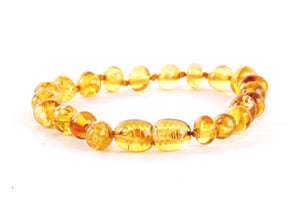 Amber Anklet Honey Beads Amber SOS