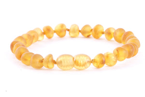 Natural Amber Anklet Amber SOS